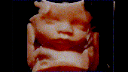 A baby is sitting in the middle of an image.