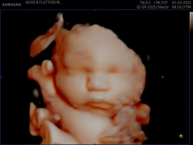 At home 3D/4D 3rd trimester- Nashville