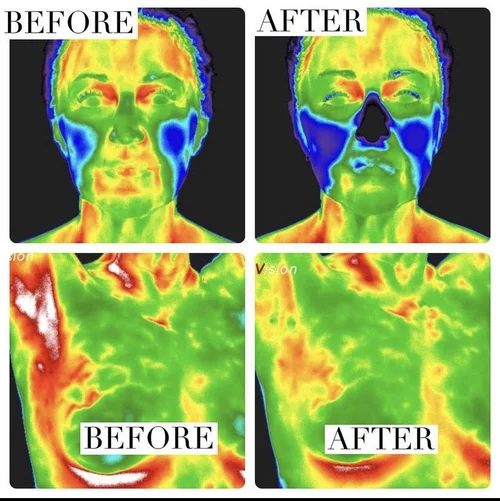 Why Sozo Wellness is Becoming a go to Wellness Destination in Middle Tennessee 3 Thermography Franklin, TN